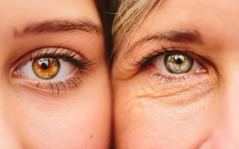 Lens